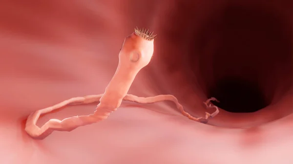 ヒト腸内寄生虫のイラスト — ストック写真
