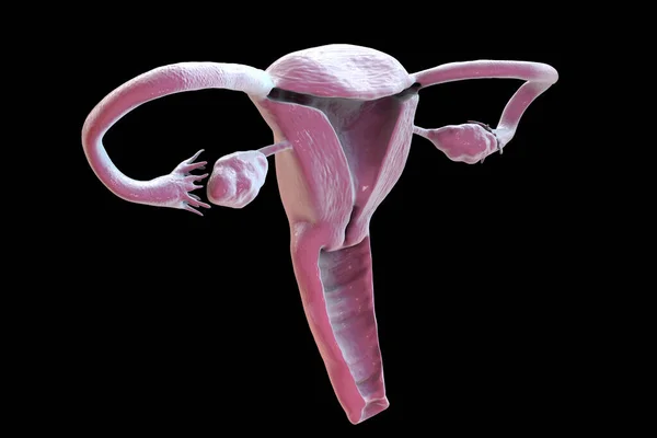 Kvinnligt Fortplantningssystem Datorillustration Mitten Finns Livmodern Livmodern Ett Päronformat Ihåligt — Stockfoto