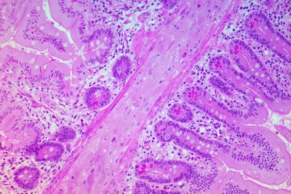 ジュヌム ジュヌム 小腸の真ん中 の粘膜層の光マイクログラフ ビリー リーバークーンの暗号とパネス細胞 ピンク の基盤を示しています 各ヴィラには 単一のコルで覆われたラミナ — ストック写真