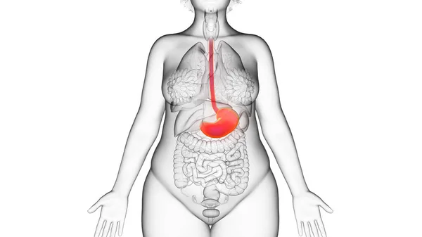 Estómago Mujer Obesa Ilustración — Foto de Stock
