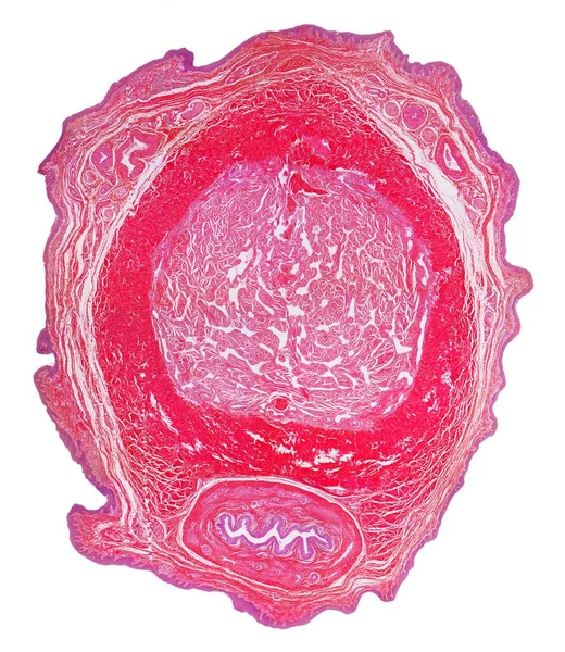 Penis Light Micrograph Section Penis Showing Corpora Cavernosa Arteries Dilate — стоковое фото