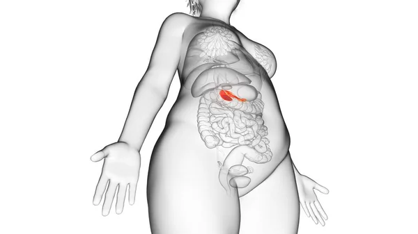 Pâncreas Mulher Obesa Ilustração — Fotografia de Stock