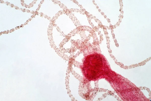 Hydra Nın Hafif Mikrografı Cnidaria Hydrozoa Sınıfının Küçük Tatlı Hayvanlarından — Stok fotoğraf