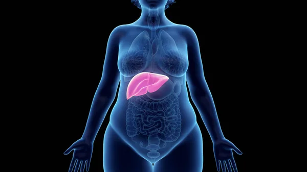 肥胖妇女的肝脏 — 图库照片