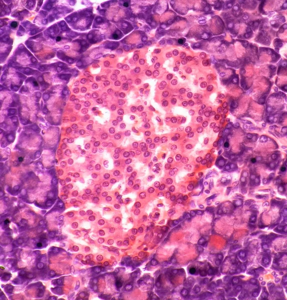 兰格汉斯岛 胰腺中的兰格汉斯岛的剖面图 胰岛是由许多分泌细胞组成的 这些细胞的主要分泌物是控制血细胞的激素 促红细胞生成素和胰岛素 — 图库照片
