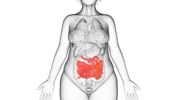 肥胖妇女的小肠 — 图库照片