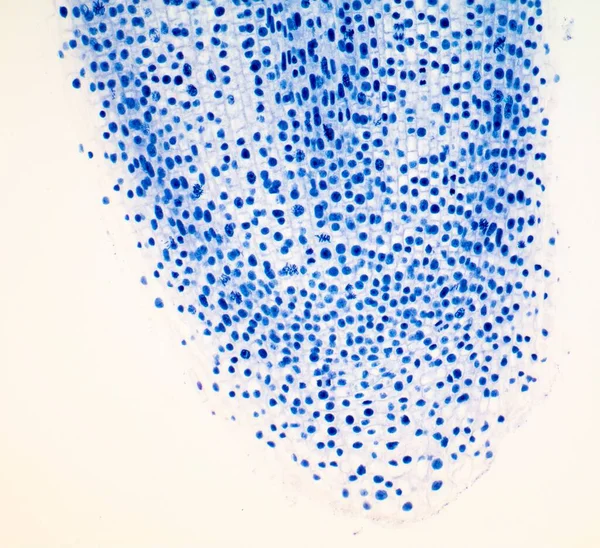ミトシス ミトシス 核分裂 の進行中の細胞を示すタマネギ アリウム受容体 のルート先端の光マイクログラフ 幅10センチメートルで印刷したときX100 — ストック写真