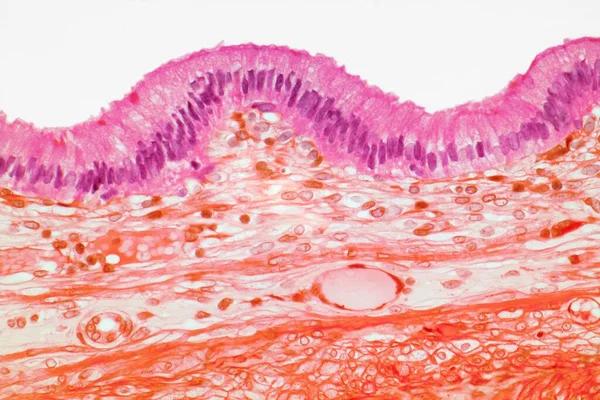 ヒトの胆嚢を介してセクションの胆嚢 光マイクログラフ 表面組織層を示しています 胆嚢は 肝胆汁を濃縮し 格納する肝臓に接続された筋肉嚢です 粘膜のラインは列で構成されています — ストック写真