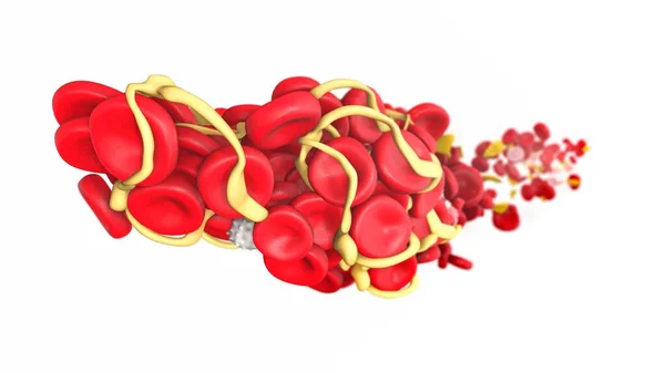 Θρόμβος Αίματος Απεικόνιση Ερυθρά Αιμοσφαίρια Αιμοπετάλια Και Ινώδες Που Σχηματίζουν — Φωτογραφία Αρχείου