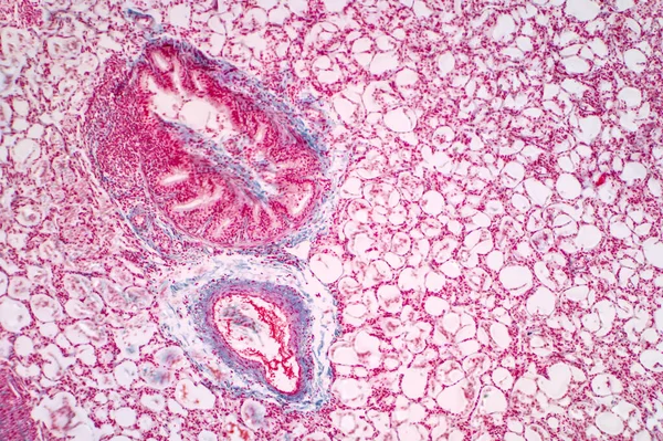 Micrografía Ligera Del Tejido Pulmonar Humano Los Pulmones Son Los — Foto de Stock