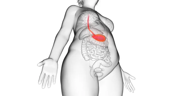 Estômago Mulher Obesa Ilustração — Fotografia de Stock