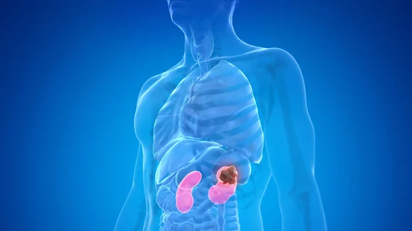 Kidney Cancer Blue Background Illustration — Stock Photo, Image