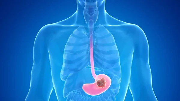 胃癌青の背景 イラスト — ストック写真