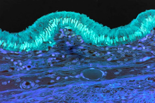 Gall Bladder Light Micrograph Section Human Gall Bladder 显示表面组织层 胆囊是连接在肝脏上的肌肉囊 — 图库照片