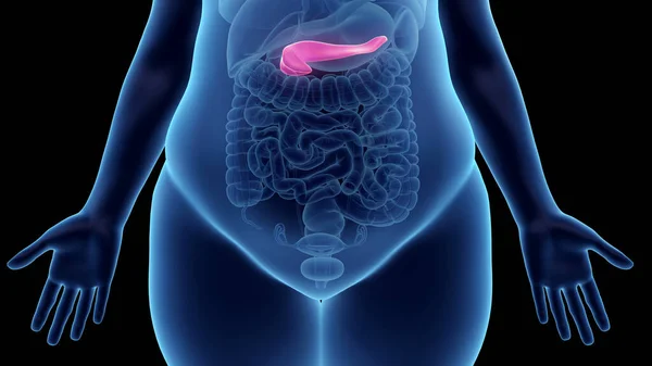 Obese Woman Pancreas Illustration — Stock Photo, Image