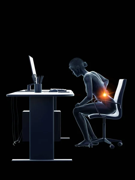Mujer Con Espalda Dolorida Mientras Trabaja Ilustración —  Fotos de Stock