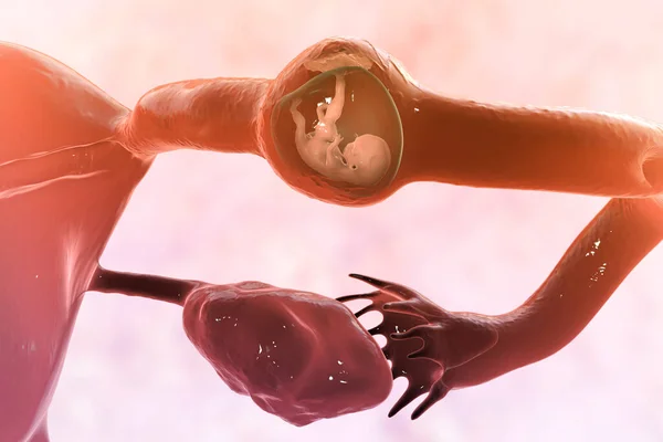 이것은 태아가 착상하는 임신입니다 난관에서 수정된 난자를 자궁으로 보내는 것이죠 — 스톡 사진