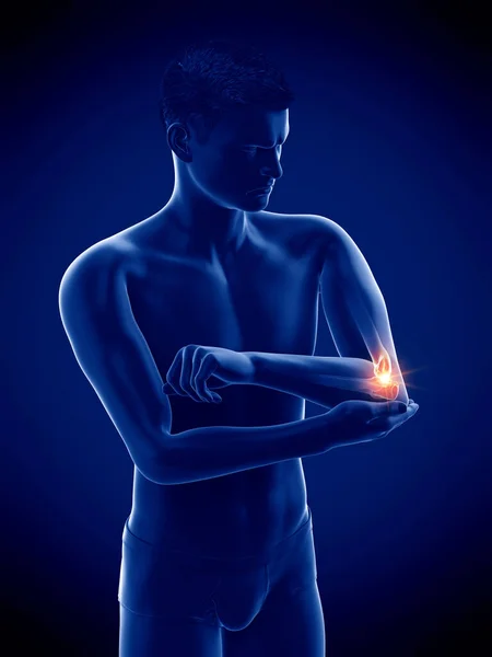 青の背景に痛みを伴う肘 イラスト — ストック写真