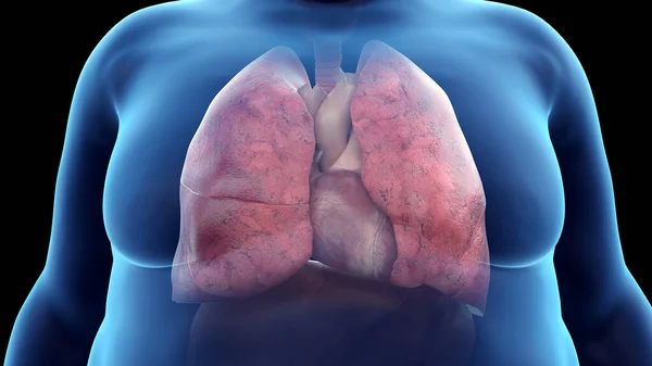 Obese Man Heart Lungs Illustration — Stock Photo, Image