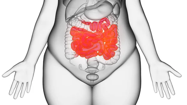Obese Woman Small Intestine Illustration — Stock Photo, Image