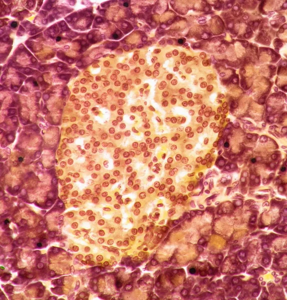 ランゲルハンス島 膵臓のランゲルハンス島を通してセクションの光マイクログラフ 島は秘密の細胞の塊で構成されています これらの細胞からの主な分泌物は 血液を制御するホルモングルカゴンとインスリンです — ストック写真