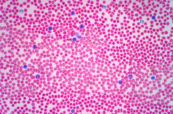 Células Sanguíneas Humanas Micrografía Ligera — Foto de Stock
