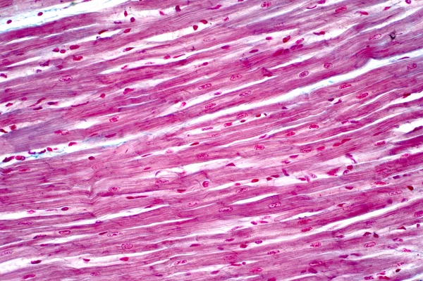 Micrografia Luz Músculo Cardíaco Humano Sob Visão Microscópio Luz Para — Fotografia de Stock