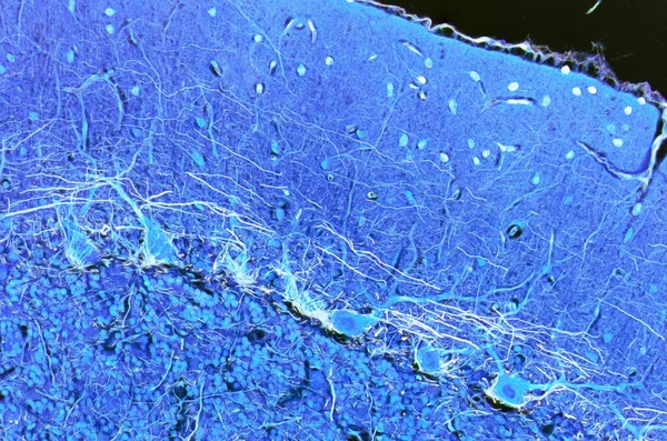 Purkinje Zenuwcellen Lichte Micrograaf Van Een Sectie Door Het Cerebellum — Stockfoto