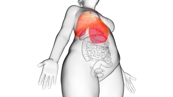 Obez Kadının Akciğeri Illüstrasyon — Stok fotoğraf