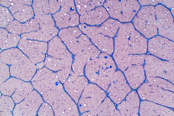 Nervo Óptico Humano Micrografia Luz — Fotografia de Stock