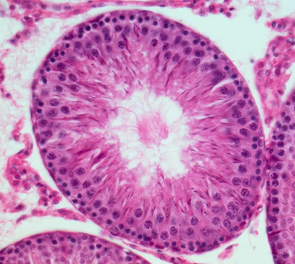 마이크로 그래프 정소를 부분이다 Seminiferous Tubules 장소이다 세포는 튤립의 가까운 — 스톡 사진