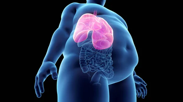 Obese Man Lung Illustration — Stock Photo, Image
