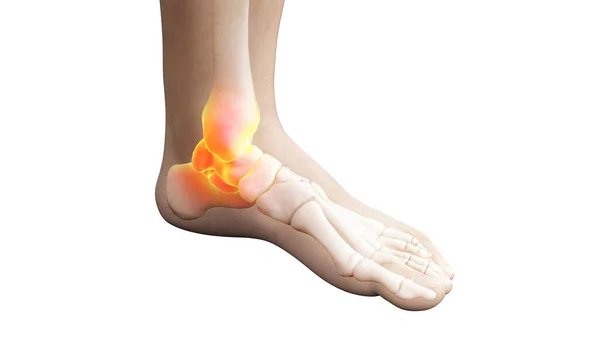 Painful Ankle Joint Illustration — Stock Photo, Image