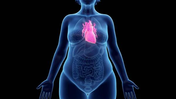 Coração Mulher Obesa Ilustração — Fotografia de Stock