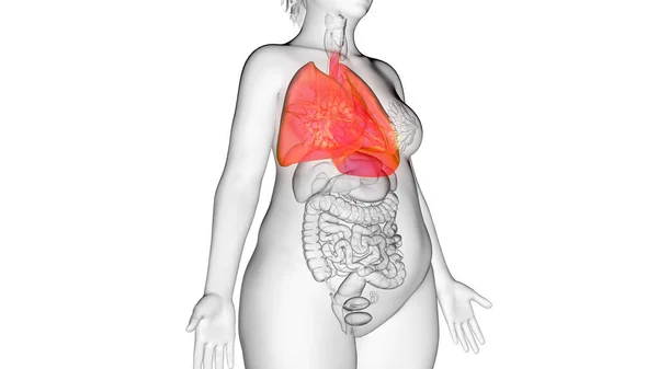 Pulmón Mujer Obesa Ilustración — Foto de Stock