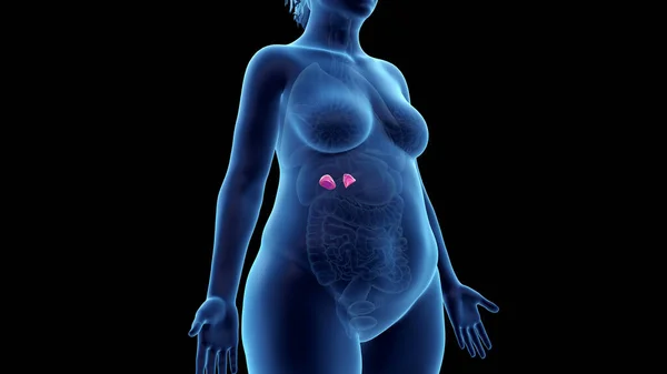 Glándulas Suprarrenales Mujer Obesa Ilustración — Foto de Stock