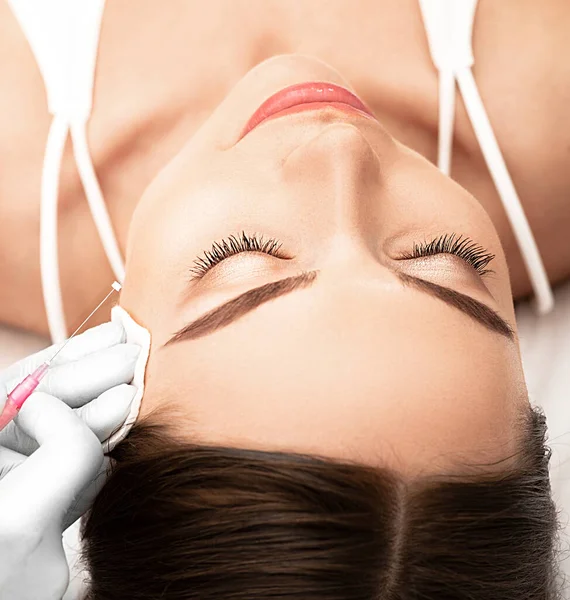 Woman Having Procedure Tighten Skin Her Face Mesothreads — Stock Photo, Image