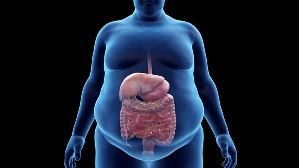 Obézní Zažívací Systém Člověka Ilustrace — Stock fotografie