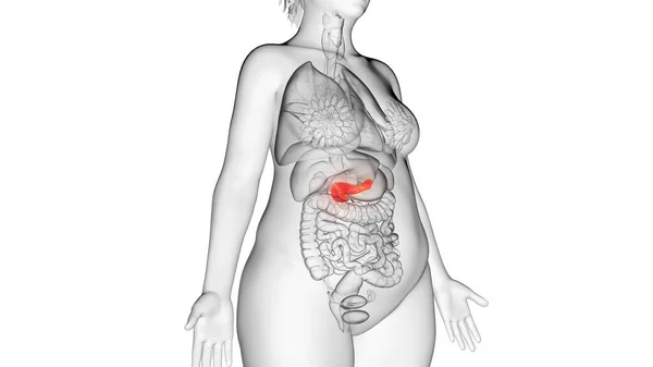 Pankreas Wanita Obese Ilustrasi — Stok Foto