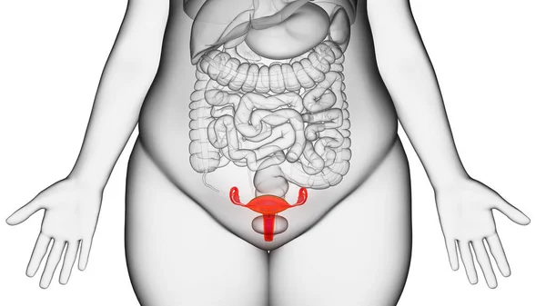 Obese Woman Uterus Illustration — Stock Photo, Image