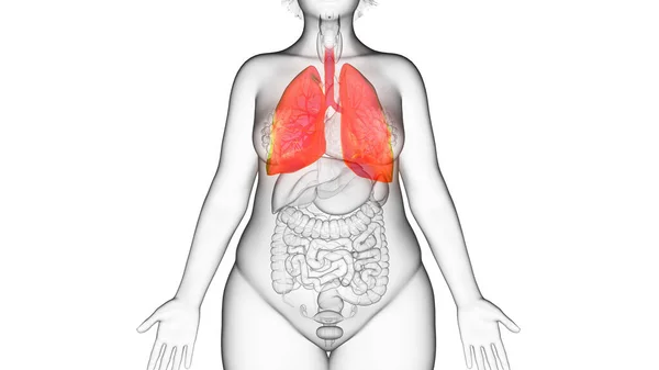 肥満女性の肺 イラスト — ストック写真