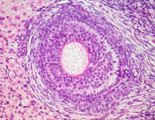 卵泡卵泡 彩色光镜 通过卵巢中的次生卵泡的切片 处于中心的是发育中的卵子的大核 卵母细胞 粉红色 卵子周围是卵泡状细胞 在那里出生 — 图库照片