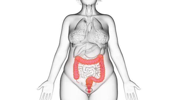 Dickdarm Fettleibiger Frauen Illustration — Stockfoto