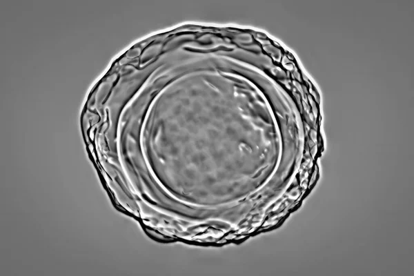 Γονιμοποιημένα Αυγά Ascaris Lumbricoides Εικόνα Αυγά Έχουν Μια Παχιά Προστατευτική — Φωτογραφία Αρχείου