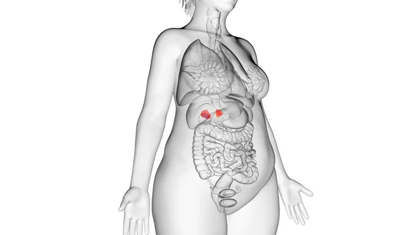 Obese Woman Adrenal Glands Illustration — Stock Photo, Image