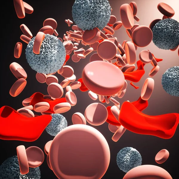 Illustratie Toont Misvormde Rode Bloedcellen Bij Thalassemie Thalassemie Een Erfelijke — Stockfoto