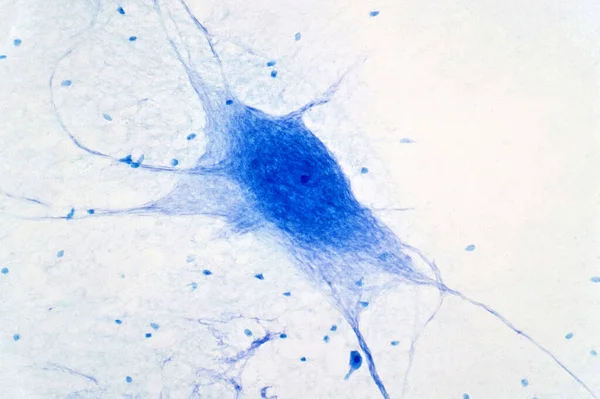 Neuronen Cellen Uit Hersenen Onder Microscoop Voor Onderwijs — Stockfoto
