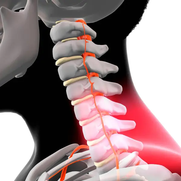 Neck Pain Conceptual Illustration — Stock Photo, Image