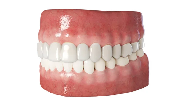 Klare Zahnärztliche Ausrichtung Illustration — Stockfoto