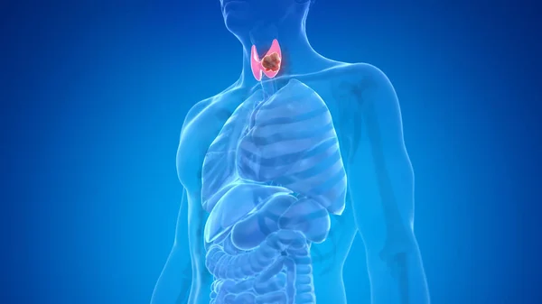 Schilddrüsenkrebs Auf Blauem Hintergrund Illustration — Stockfoto